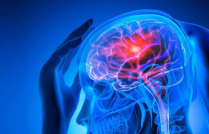 في اليوم العالمي للسكتة الدماغية… تحذير من علامات مبكرة قد تنقذ حياتك