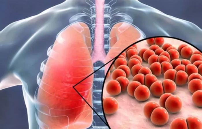 خطوة بحثية واعدة: لقاح جديد ضد السّل قيد التطوير